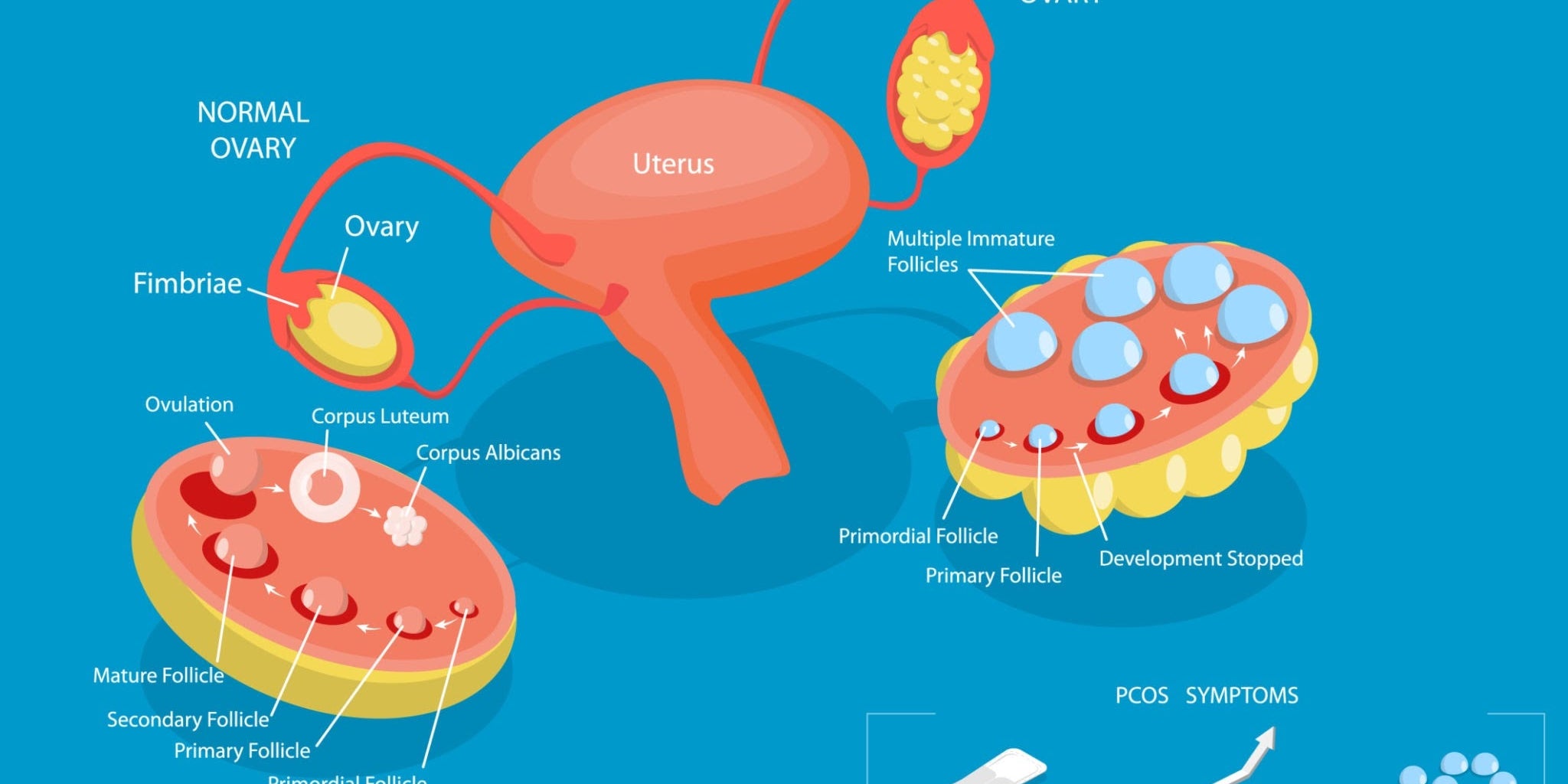 PCOS and Fertility: What You Need to Know When Trying to Conceive