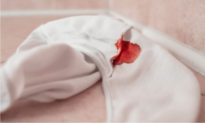 how to remove period blood stains out of underwear